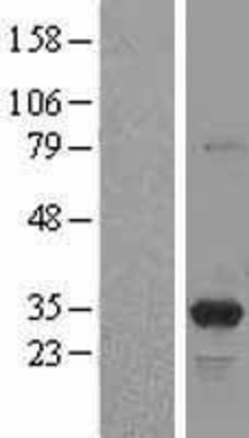 Western Blot: PSME3 Overexpression Lysate (Adult Normal) [NBL1-14909] Left-Empty vector transfected control cell lysate (HEK293 cell lysate); Right -Over-expression Lysate for PSME3.