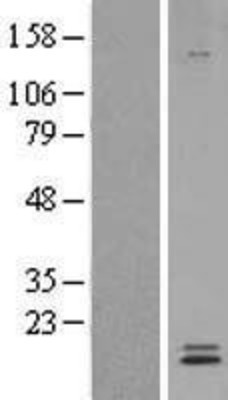 Western Blot: Ly-6E Overexpression Lysate (Adult Normal) [NBL1-12748] Left-Empty vector transfected control cell lysate (HEK293 cell lysate); Right -Over-expression Lysate for Ly-6E.