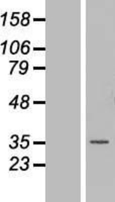 Western Blot: MNAT1 Overexpression Lysate (Adult Normal) [NBL1-13164] Left-Empty vector transfected control cell lysate (HEK293 cell lysate); Right -Over-expression Lysate for MNAT1.