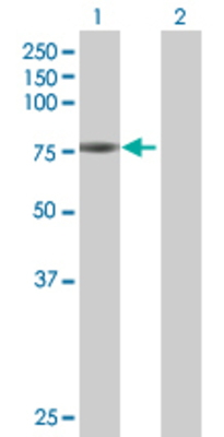 Lane 1: HAL transfected lysate (72.7 KDa) Lane 2: Non-transfected lysate.