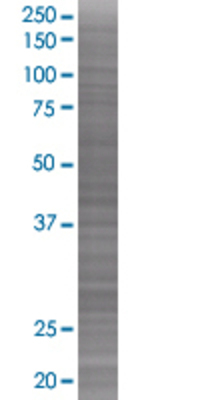 STC2 transfected lysate.