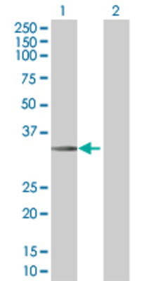 Lane 1: STC2 transfected lysate (33.2 KDa) Lane 2: Non-transfected lysate.