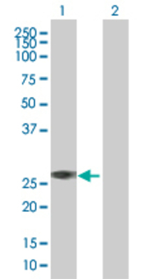 Lane 1: DIRAS1 transfected lysate (22.3 KDa). Lane 2: Non-transfected lysate.