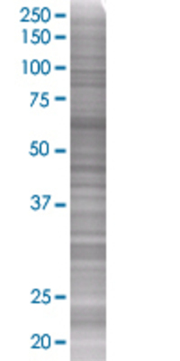 DIRAS1 transfected lysate