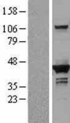 Western Blot: DHPS Overexpression Lysate (Adult Normal) [NBL1-09864] Left-Empty vector transfected control cell lysate (HEK293 cell lysate); Right -Over-expression Lysate for DHPS.