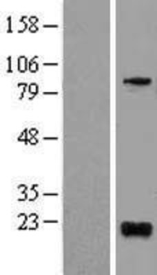 Western Blot: BTG1 Overexpression Lysate (Adult Normal) [NBL1-08047] Left-Empty vector transfected control cell lysate (HEK293 cell lysate); Right -Over-expression Lysate for BTG1.