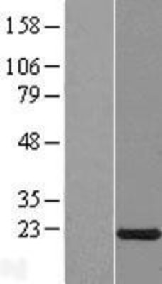 Western Blot: CXorf40A Overexpression Lysate (Adult Normal) [NBL1-09642] Left-Empty vector transfected control cell lysate (HEK293 cell lysate); Right -Over-expression Lysate for CXorf40A.