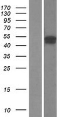 Western Blot: FBXO31 Overexpression Lysate (Adult Normal) [NBL1-10631] Left-Empty vector transfected control cell lysate (HEK293 cell lysate); Right -Over-expression Lysate for FBXO31.