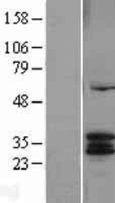 Western Blot: CYC1 Overexpression Lysate (Adult Normal) [NBL1-09661] Left-Empty vector transfected control cell lysate (HEK293 cell lysate); Right -Over-expression Lysate for CYC1.