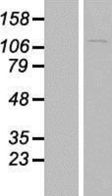 Western Blot: CENPC Overexpression Lysate (Adult Normal) [NBL1-09083] Left-Empty vector transfected control cell lysate (HEK293 cell lysate); Right -Over-expression Lysate for CENPC.