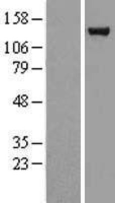 Western Blot: USP7 Overexpression Lysate (Adult Normal) [NBL1-17671] Left-Empty vector transfected control cell lysate (HEK293 cell lysate); Right -Over-expression Lysate for USP7.
