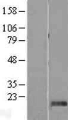 Western Blot: DPH4 Overexpression Lysate (Adult Normal) [NBL1-09952] Left-Empty vector transfected control cell lysate (HEK293 cell lysate); Right -Over-expression Lysate for DPH4.