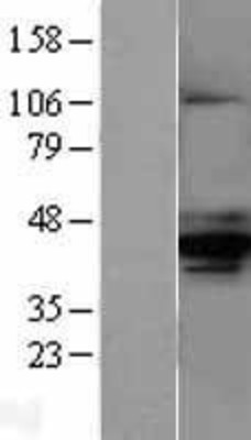 Western Blot: AMACR Overexpression Lysate (Adult Normal) [NBL1-07494] Left-Empty vector transfected control cell lysate (HEK293 cell lysate); Right -Over-expression Lysate for AMACR.