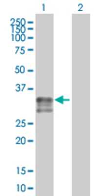 Lane 1: HLA-DRA transfected lysate (28.6 KDa). Lane 2: Non-transfected lysate.