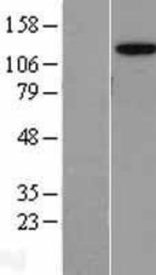 Western Blot: AP3B2 Overexpression Lysate (Adult Normal) [NBL1-07584] Left-Empty vector transfected control cell lysate (HEK293 cell lysate); Right -Over-expression Lysate for AP3B2.