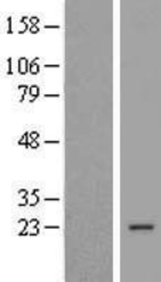 Western Blot: COPS8 Overexpression Lysate (Adult Normal) [NBL1-09385] Left-Empty vector transfected control cell lysate (HEK293 cell lysate); Right -Over-expression Lysate for COPS8.