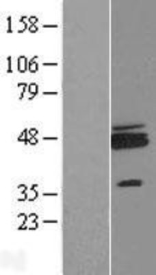 Western Blot: ZNF364 Overexpression Lysate (Adult Normal) [NBL1-15414] Left-Empty vector transfected control cell lysate (HEK293 cell lysate); Right -Over-expression Lysate for ZNF364.