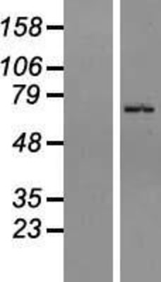 Western Blot: ZNF133 Overexpression Lysate (Adult Normal) [NBL1-18056] Left-Empty vector transfected control cell lysate (HEK293 cell lysate); Right -Over-expression Lysate for ZNF133.