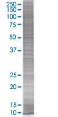 HEXIM1 transfected lysate