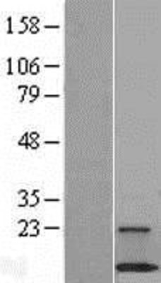 Western Blot: C18orf32 Overexpression Lysate (Adult Normal) [NBL1-08254] Left-Empty vector transfected control cell lysate (HEK293 cell lysate); Right -Over-expression Lysate for C18orf32.