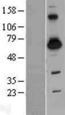 Western Blot: SH3BP2 Overexpression Lysate (Adult Normal) [NBL1-15927] Left-Empty vector transfected control cell lysate (HEK293 cell lysate); Right -Over-expression Lysate for SH3BP2.