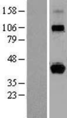 Western Blot: HLA G Overexpression Lysate (Adult Normal) [NBL1-11592] Left-Empty vector transfected control cell lysate (HEK293 cell lysate); Right -Over-expression Lysate for HLA G.