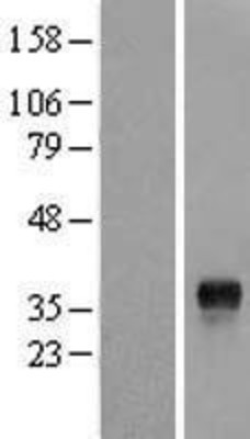 Western Blot: GEM Overexpression Lysate (Adult Normal) [NBL1-11037] Left-Empty vector transfected control cell lysate (HEK293 cell lysate); Right -Over-expression Lysate for GEM.