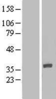 Western Blot: IQCK Overexpression Lysate (Adult Normal) [NBL1-12024] Left-Empty vector transfected control cell lysate (HEK293 cell lysate); Right -Over-expression Lysate for IQCK.