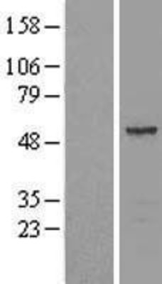 Western Blot: Septin-11 Overexpression Lysate (Adult Normal) [NBL1-07152] Left-Empty vector transfected control cell lysate (HEK293 cell lysate); Right -Over-expression Lysate for Septin-11.