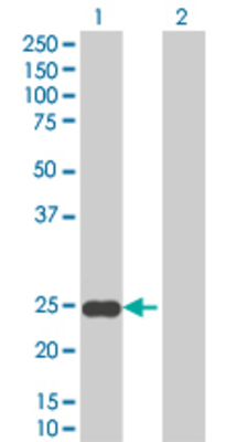 Lane 1: SFRS2 transfected lysate (19.8 KDa). Lane 2: Non-transfected lysate.