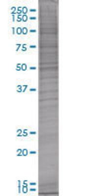 SFRS2 transfected lysate