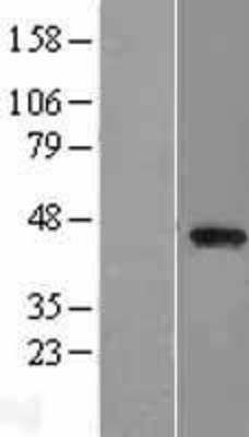 Western Blot: PARVB Overexpression Lysate (Adult Normal) [NBL1-14121] Left-Empty vector transfected control cell lysate (HEK293 cell lysate); Right -Over-expression Lysate for PARVB.