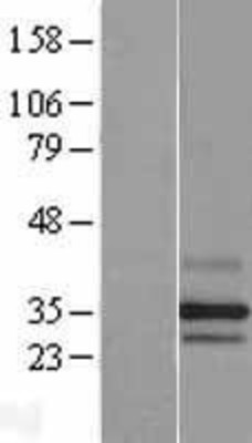 Western Blot: PARL Overexpression Lysate (Adult Normal) [NBL1-14107] Left-Empty vector transfected control cell lysate (HEK293 cell lysate); Right -Over-expression Lysate for PARL.