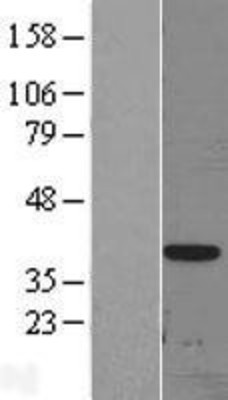 Western Blot: DLX3 Overexpression Lysate (Adult Normal) [NBL1-09918] Left-Empty vector transfected control cell lysate (HEK293 cell lysate); Right -Over-expression Lysate for DLX3.