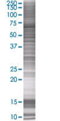 MTMR6 transfected lysate.