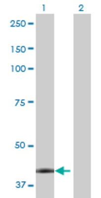 Lane 1: CA12 transfected lysate (39.05 KDa) Lane 2: Non-transfected lysate.