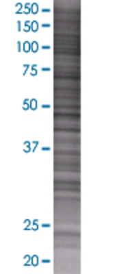 POMC transfected lysate.