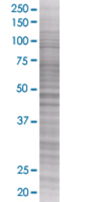 BDKRB1 transfected lysate.