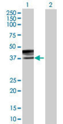 Lane 1: CD207 transfected lysate (36.19 KDa) Lane 2: Non-transfected lysate.