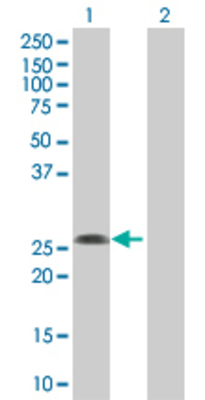 Lane 1: YEATS4 transfected lysate (25.08 KDa) Lane 2: Non-transfected lysate.