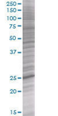 YEATS4 transfected lysate.