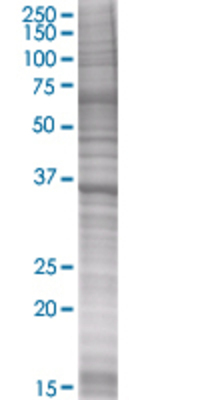 GAPDH transfected lysate