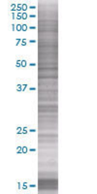 PRR11 transfected lysate.
