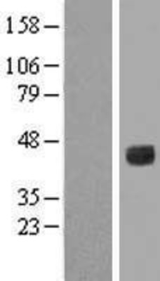 Western Blot: IL6R Overexpression Lysate (Adult Normal) [NBP2-04920] Left-Empty vector transfected control cell lysate (HEK293 cell lysate); Right -Over-expression Lysate for IL6R.