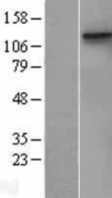 Western Blot: DDR1 Overexpression Lysate (Adult Normal) [NBL1-09777] Left-Empty vector transfected control cell lysate (HEK293 cell lysate); Right -Over-expression Lysate for DDR1.