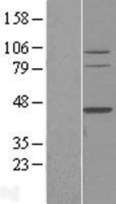 Western Blot: TFB2M Overexpression Lysate (Adult Normal) [NBL1-16832] Left-Empty vector transfected control cell lysate (HEK293 cell lysate); Right -Over-expression Lysate for TFB2M.