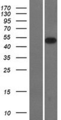 Western Blot: SMOC2 Overexpression Lysate (Adult Normal) [NBL1-16248] Left-Empty vector transfected control cell lysate (HEK293 cell lysate); Right -Over-expression Lysate for SMOC2.