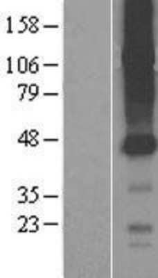 Western Blot: SLCO4C1 Overexpression Lysate (Adult Normal) [NBP2-04441] Left-Empty vector transfected control cell lysate (HEK293 cell lysate); Right -Over-expression Lysate for SLCO4C1.
