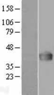 Western Blot: DDAH1 Overexpression Lysate (Adult Normal) [NBP2-04327] Left-Empty vector transfected control cell lysate (HEK293 cell lysate); Right -Over-expression Lysate for DDAH1.