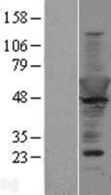 Western Blot: Copine-6 Overexpression Lysate (Adult Normal) [NBP2-04307] Left-Empty vector transfected control cell lysate (HEK293 cell lysate); Right -Over-expression Lysate for Copine-6.